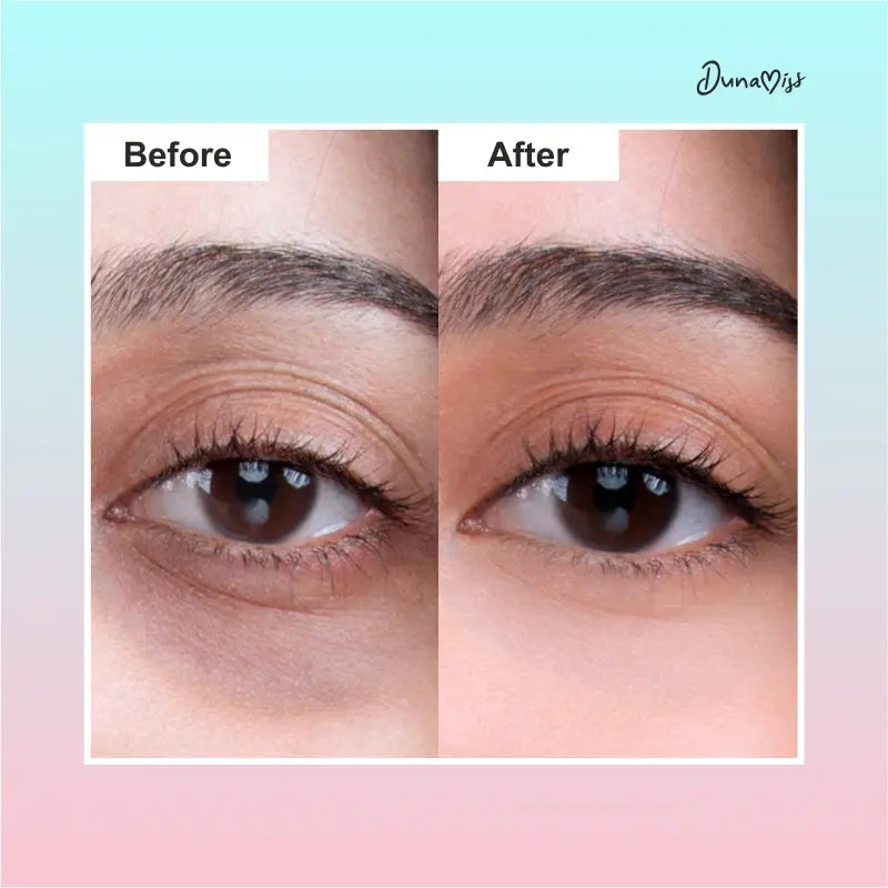 Eye Balm Dunamiss Cosmetics Private Limited